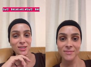 Letícia Cazarré revela procedimento estético no rosto: - <i>O pós-operatório é meio chatinho</i>