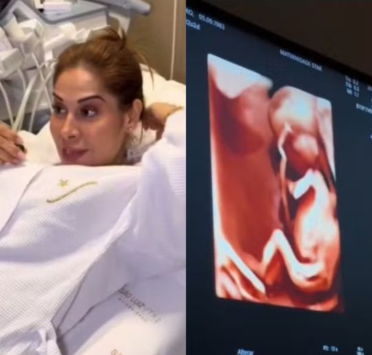 Maíra Cardi faz ultrassom morfológico e desabafa: <I>Um dos exames mais importantes</i>. Veja tudo que sabemos sobre a segunda gestação do casal