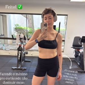 Fabiana Justus revela tratamento após reação ao transplante de medula: <i>Eu acabei inchando uns dois quilos</i>