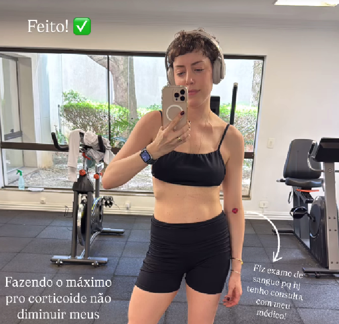 Fabiana Justus revela tratamento após reação ao transplante de medula: <i>Eu acabei inchando uns dois quilos</i>