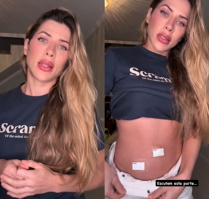 Ana Paula Minerato conta que passou por cirurgia e revela diagnóstico de inflamações no útero e intestino