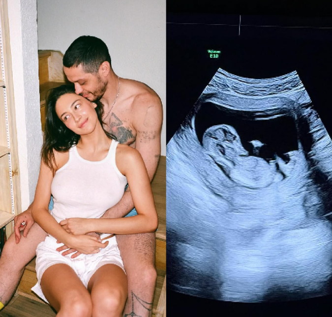 Pete Davidson e Elsie Hewitt revelam que estão à espera do primeiro filho. Veja os famosos que anunciaram a gravidez em 2025!