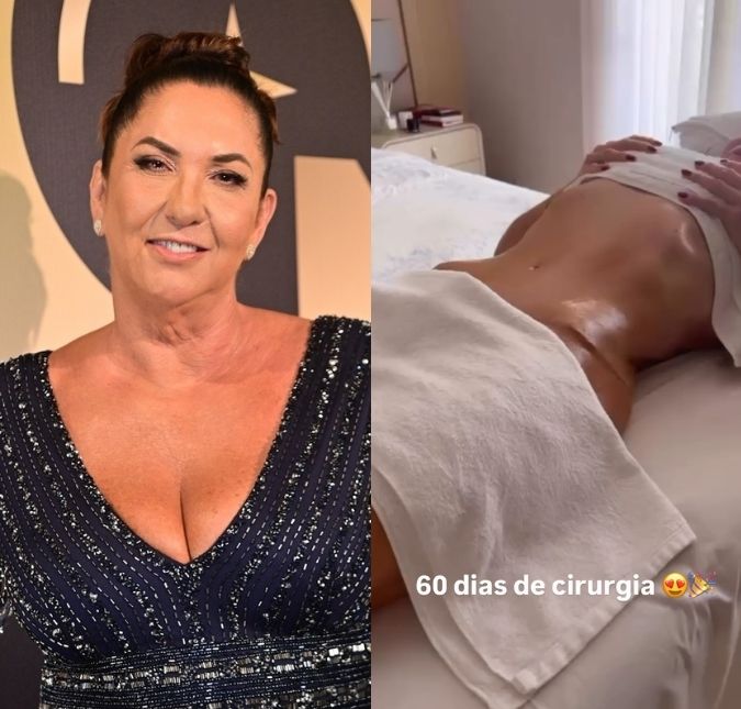 Margareth Serrão, mãe de Virginia Fonseca, mostra barriga 60 dias após procedimentos estéticos