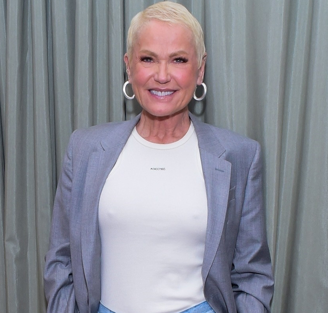 Xuxa Meneghel explica decisão de fazer transplante capilar: <i>Estava vendo uns buracos</i>