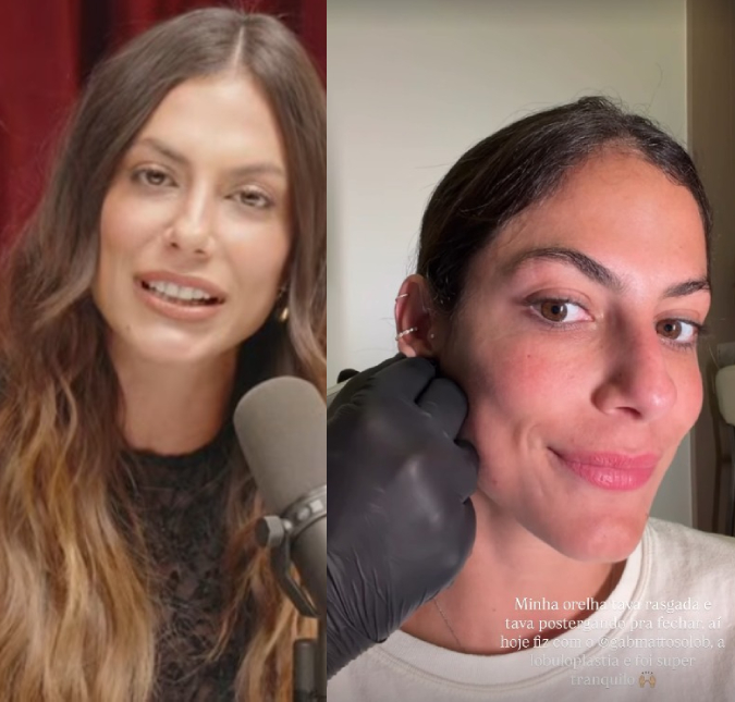 Mari Gonzalez realiza procedimento na orelha: <i>Tava rasgada</i>