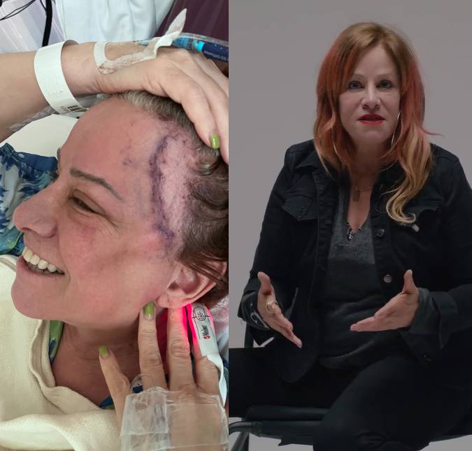 Vocalista e baixista do <i>L7</i>, Jennifer Finch mostra cicatriz de cirurgia após diagnóstico de câncer agressivo no cérebro