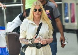Após procedimento no rosto, Monique Evans compartilha dificuldades e expectativas do pós-operatório