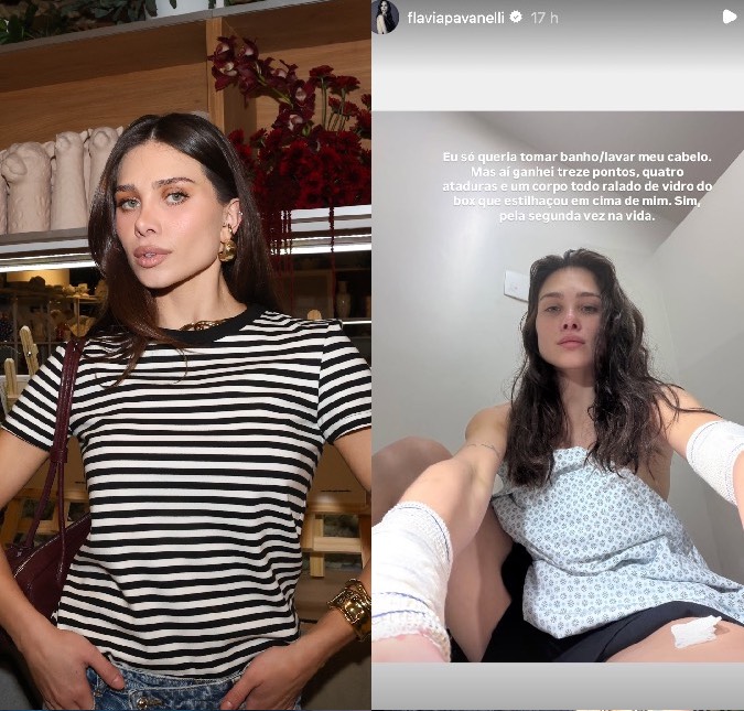 Flavia Pavanelli desabafa ao levar 13 pontos após acidente no banheiro: <i>Box estilhaçou em mim</i>