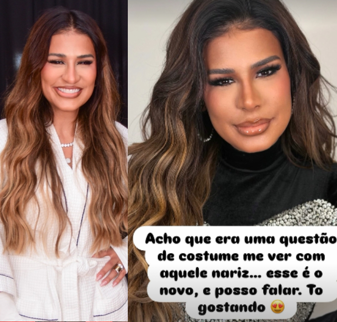 Após receber novas críticas sobre mudança na aparência, Simone Mendes volta a se pronunciar sobre o nariz: <i>Estou gostando</i>