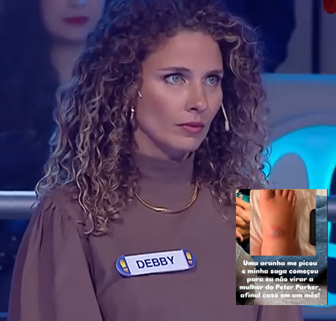 Susto! Debby Lagranha é picada por aranha e vai parar no hospital